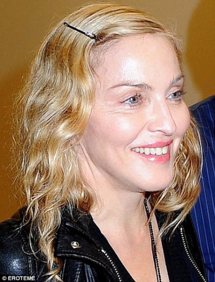 Speciālisti saskaitījuši Madonnas plastiskās operācijas (FOTO) (Bilde 1)