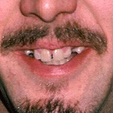 Slavenību maģiskās zobu pārvērtības (FOTO) (Bilde 1)