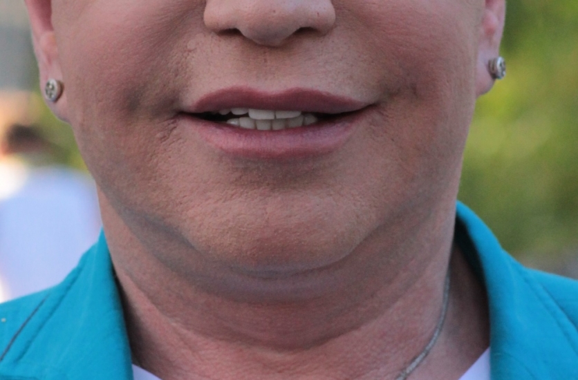 Jaunā Viļņa zvaigzne atņirdz savus Latvijā ieliktos zobus - FOTO (Bilde 2)