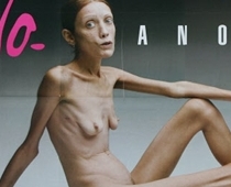 Modele Izabella Karo zaudējusi cīņā ar anoreksiju