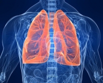 Šodien atzīmē Pasaules Pulmonālās hipertensijas dienu