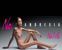 Milānas modes nedēļas atklāšanā aktualizē bīstamo anoreksijas problēmu